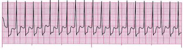 The Ultimate Guide To Acls Pre Assessment Test Answers Everything You Need To Know