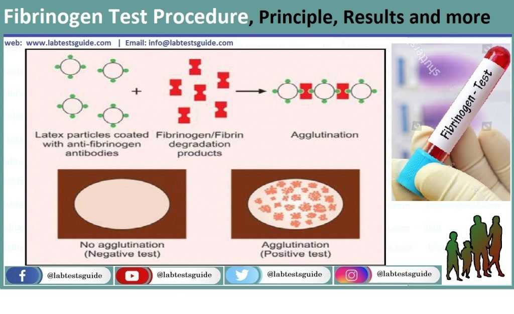 How does the laboratory test work?