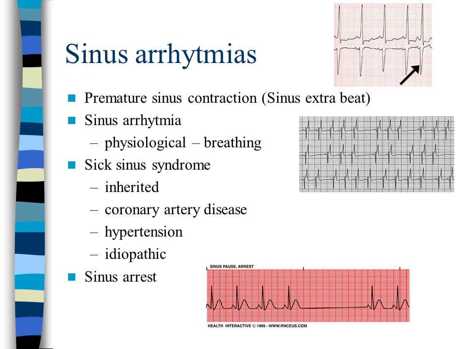 The Purpose of the Relias Dysrhythmia Basic Test