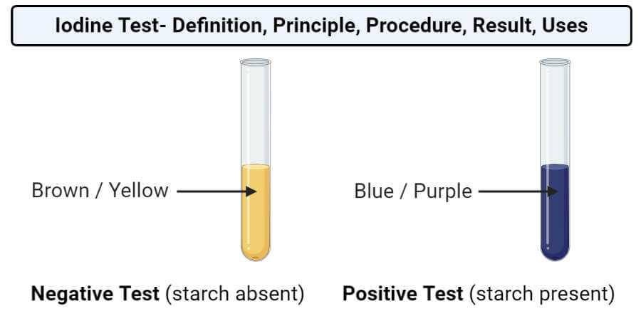 The Importance of Positive Lipid Tests