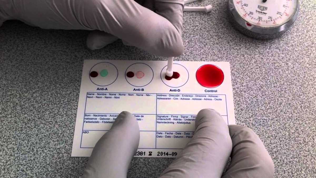 ATI Blood Administration Posttest: The Comprehensive Guide