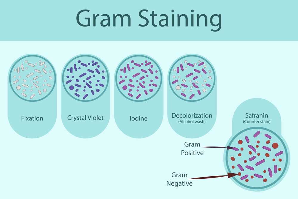 Crystal violet lab report answers