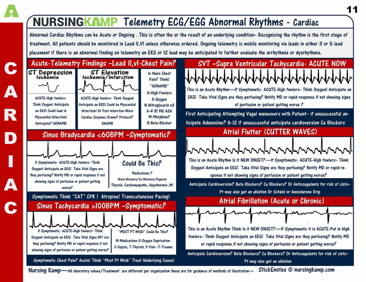 Dysrhythmia - Understanding the Essentials for Reliable Answers Dysrhythmia basic a relias answers