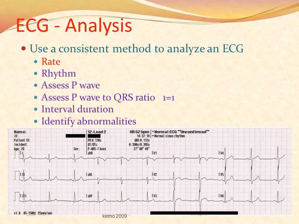 Diagnostic Tools for Dysrhythmia