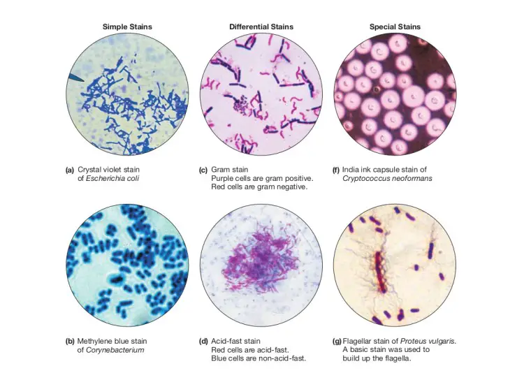 Crystal Violet Lab Report Answers