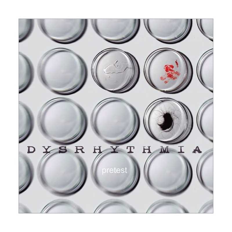 The Benefits of Prophecy Dysrhythmia Advanced Test