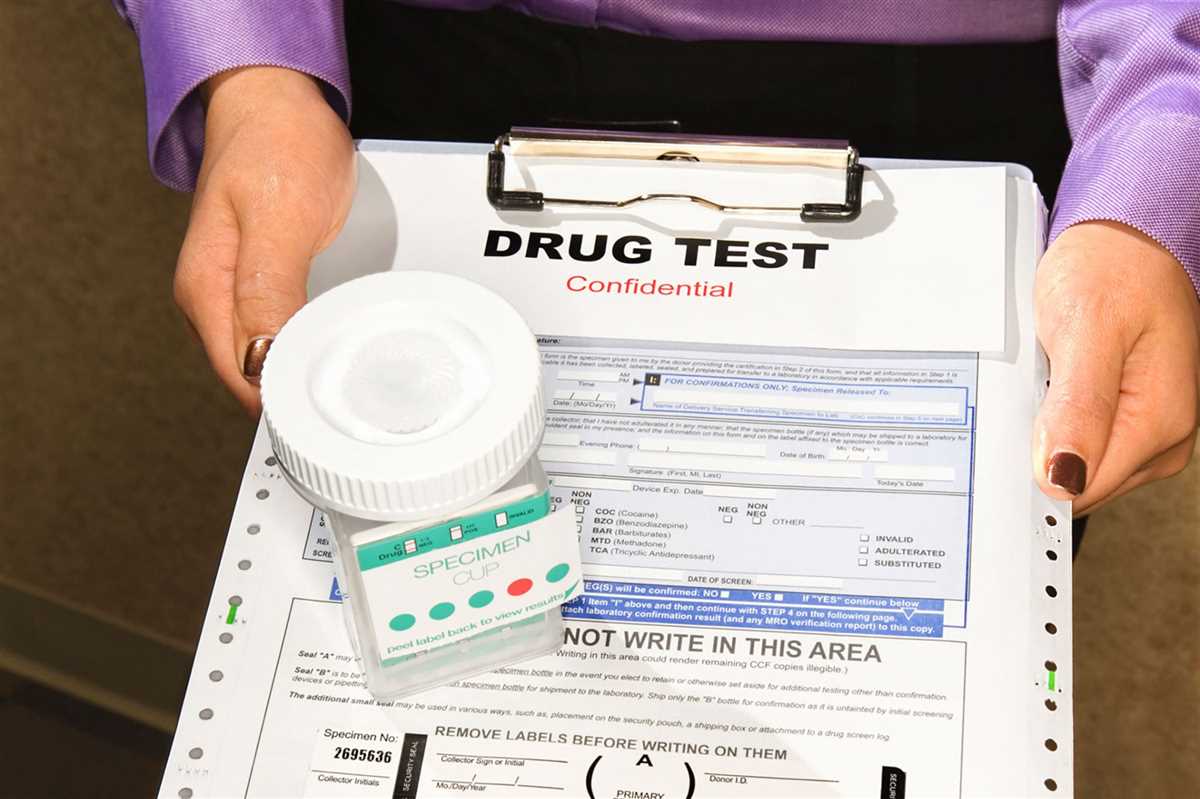 Types of Drugs Detected by a Chamberlain Drug Test