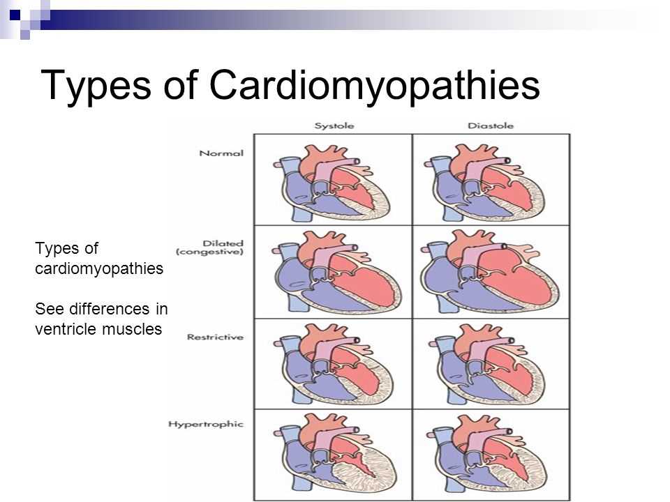 Common dysrhythmia patterns: