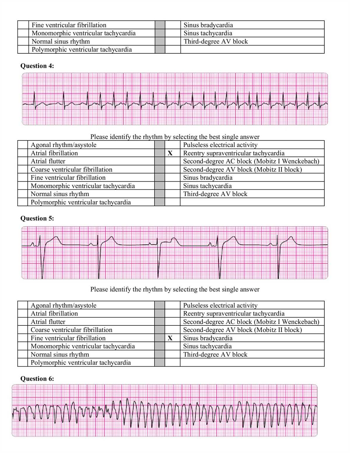 Understanding the Heartcode ACLS Written Exam