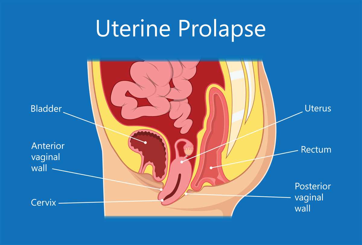 Importance of Regular Female Pelvic Exams