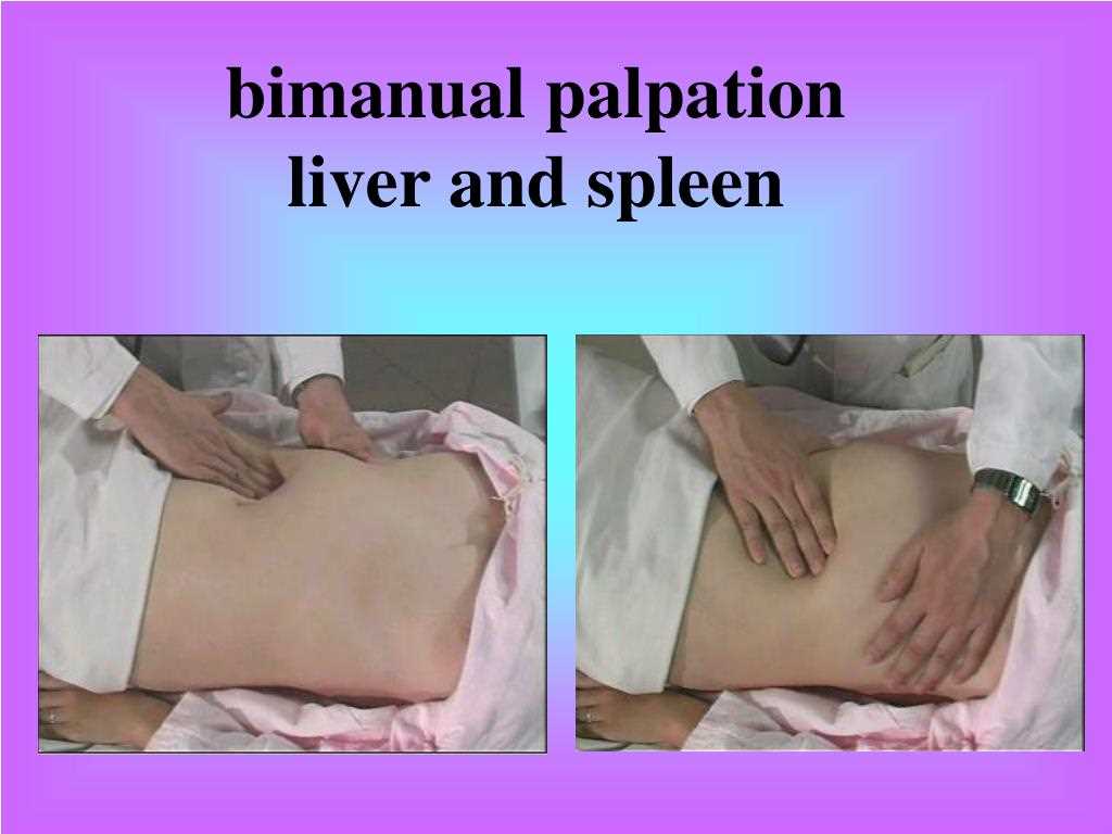 Step by Step Guide Performing A Bimanual Pelvic Exam Video Step by Step Guide Performing A Bimanual Pelvic Exam Video