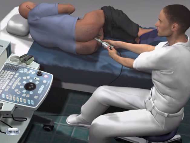 A Glimpse into the Doctor's Office: What Happens During a Prostate Exam?