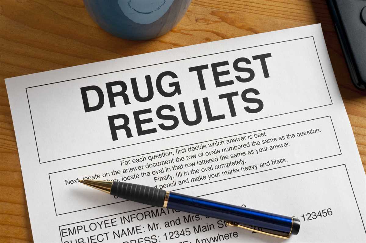 Tips for Passing the Drug and Alcohol Test with Flying Colors
