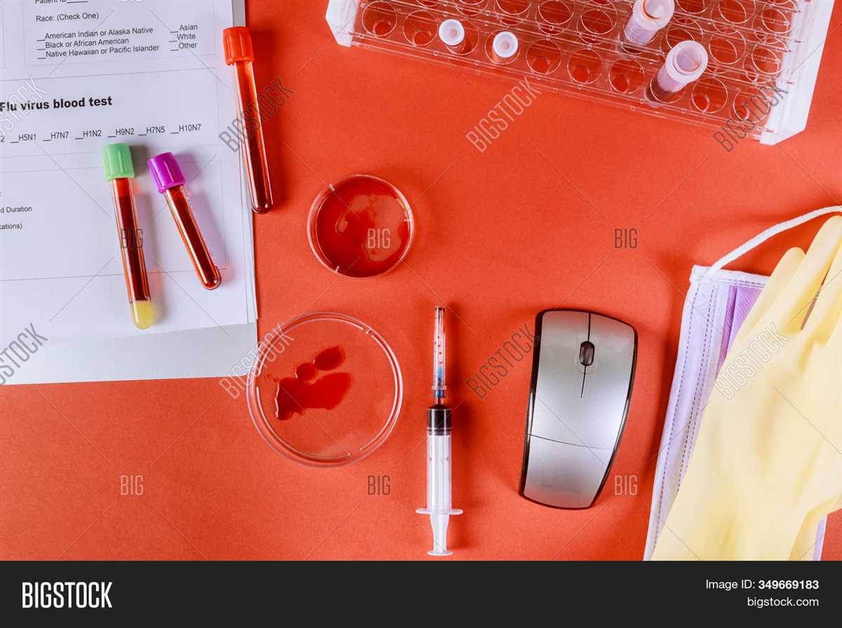 Key Tips for Lab Preparation: